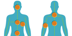 Visual representation of key areas on the human body for radiology imaging.