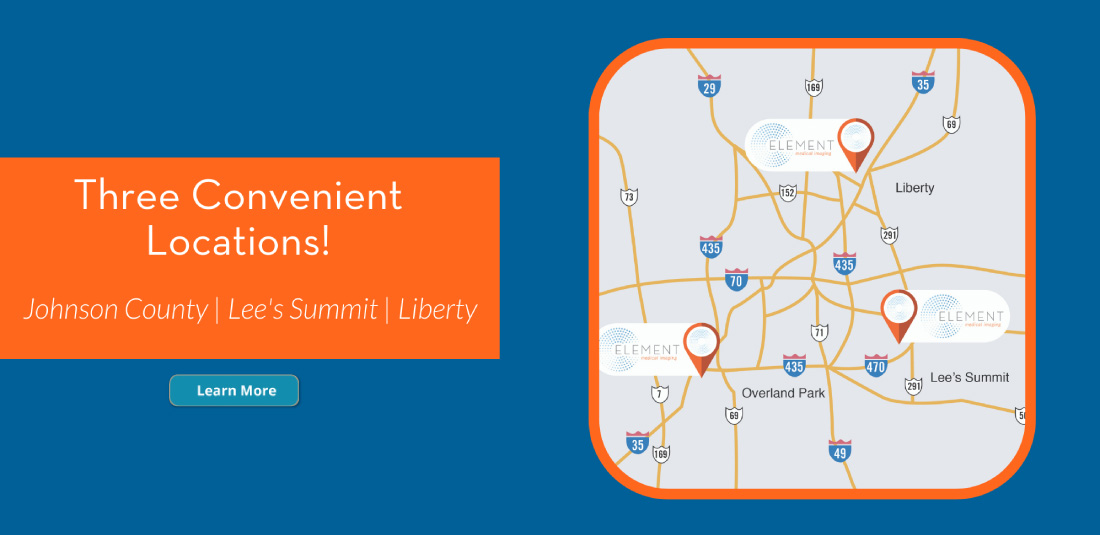 Map of our radiology and diagnostic centers across Kansas City.